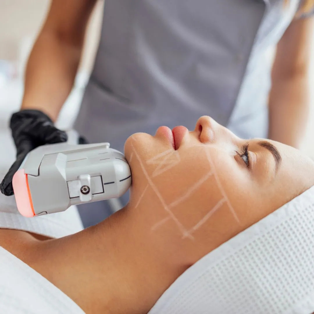 HIFU 12D Facial