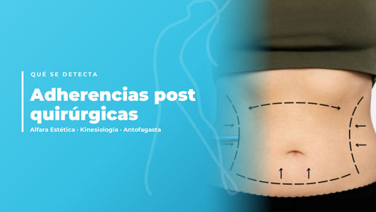 Adherencias post quirúrgicas — Alfara Estética, kinesiología en Antofagasta