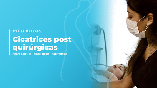 Cicatrices post quirúrgicas — Alfara Estética, kinesiología en Antofagasta
