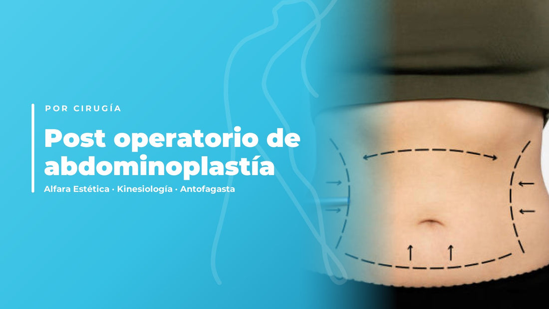 Post operatorio de abdominoplastía — Alfara Estética, kinesiología en Antofagasta