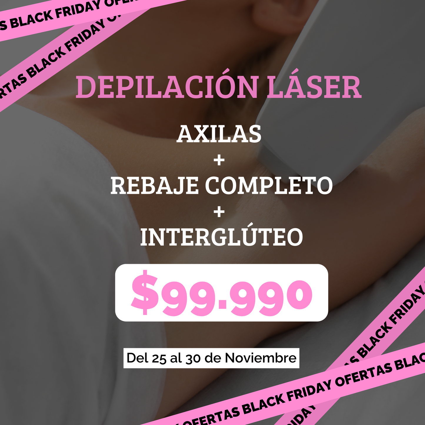 DEPILACIÓN LÁSER – Axilas + Rebaje + Interglúteo BLACK (6 SESIONES)