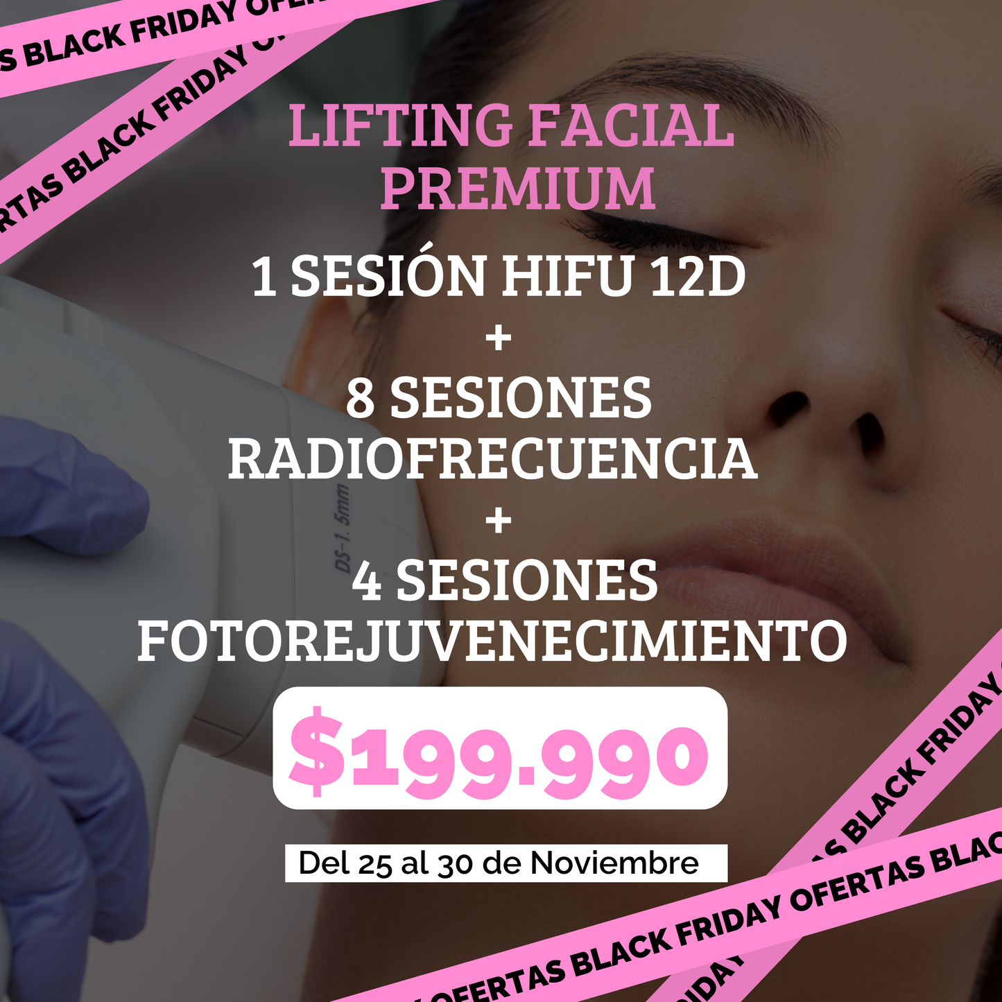 LIFTING FACIAL PREMIUM – HIFU 12D + 8 Radiofrecuencia + 4 Fotorejuvenecimiento BLACK