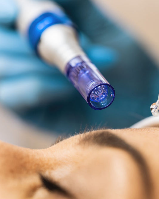 MICRONEEDLING